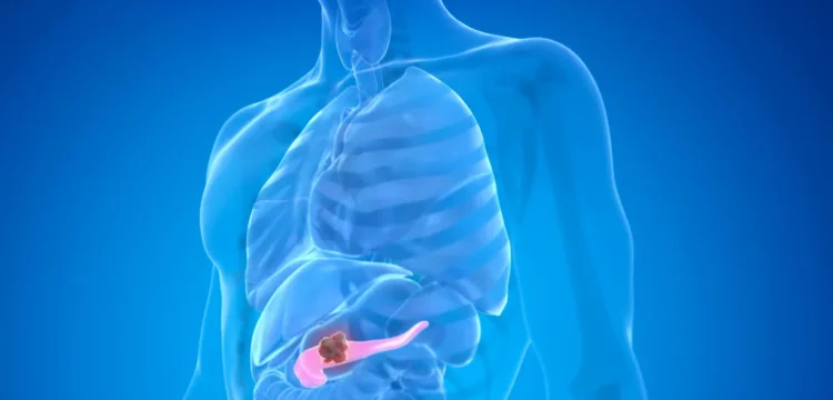 5 Rekomendasi Vitamin dan Suplemen untuk Pankreas Sehat